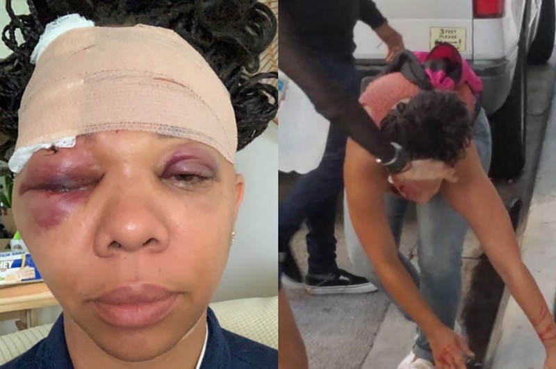 LaToya Ratlieff was struck by a rubber bullet fired by a Fort Lauderdale police officer during a 2020 protest against police brutality.