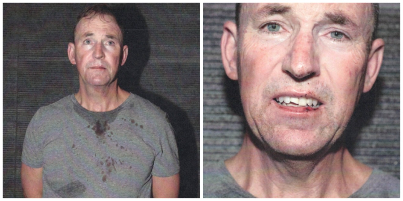 Photos taken by the police department show Younger's T-shirt speckled with blood and one of his front teeth broken.