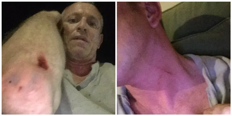 Image: Yuri Star's injuries after he was allegedly attacked by Morgan O'Connor.