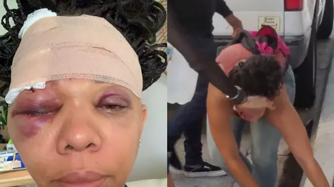 SIde-by-side images of (left) LaToya Ratlieff's swollen face after she was struck by a rubber bullet and (right) Ratlieff bleeding after she was hit.