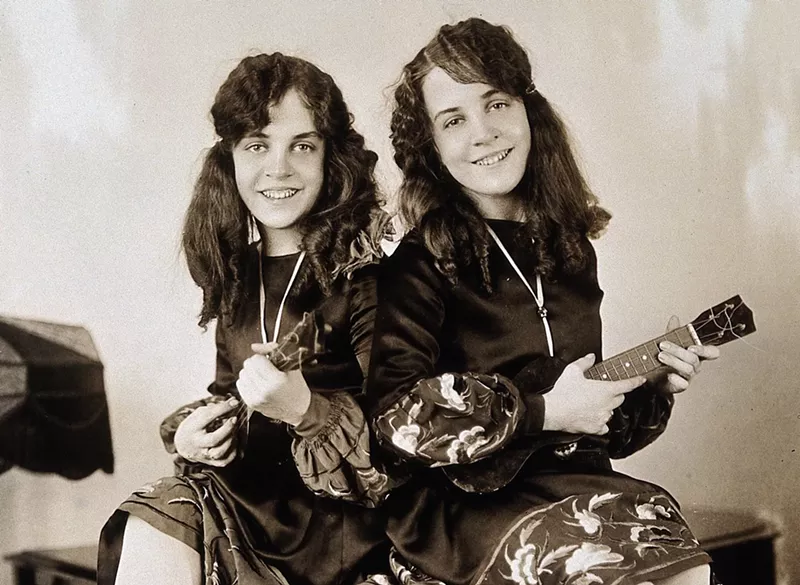 Image: The Hilton Twins at 19 years of age.