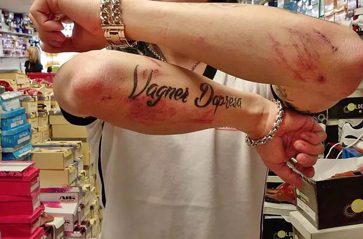 Vagner Dapresa shows injuries after he was attacked by a homophobic clerk at a West Flagler gas station, he says. - PHOTO VIA PROPUBLICA